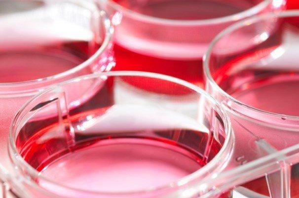 درمان ضایعات کبدی با سلول بنیادی توسط محققان کشور